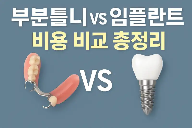 부분틀니 vs 임플란트 비용 비교 총정리