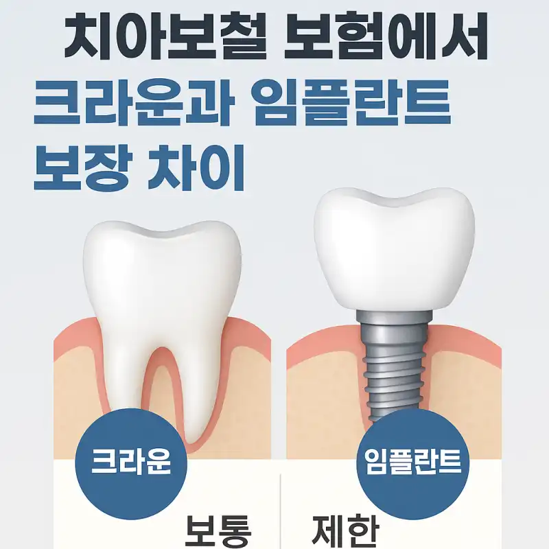 치아보철 보험에서 크라운과 임플란트 보장 차이